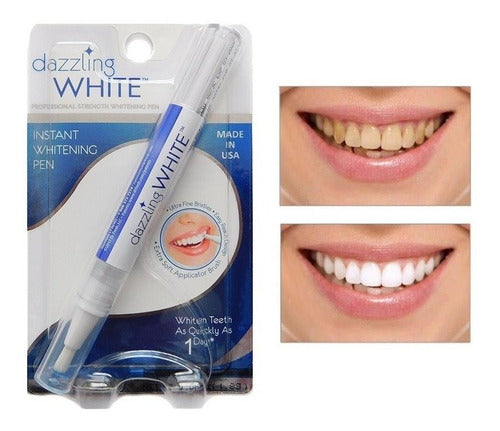Blanqueamiento dental