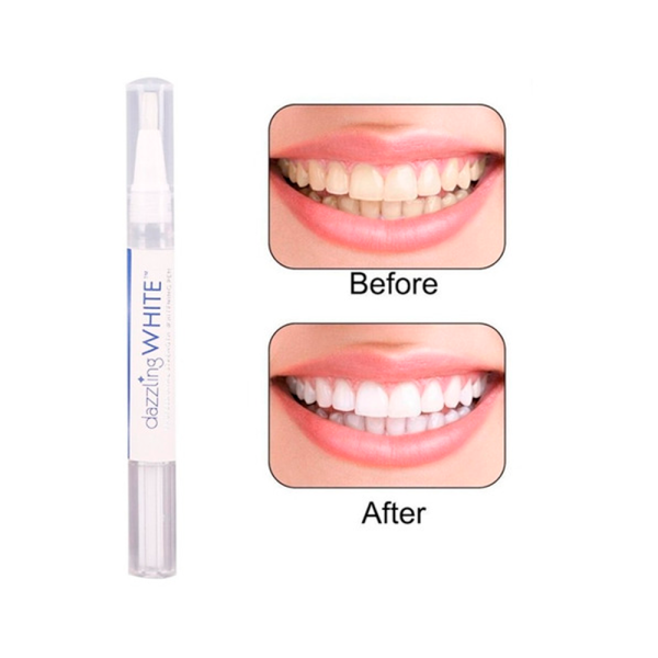 Blanqueamiento dental